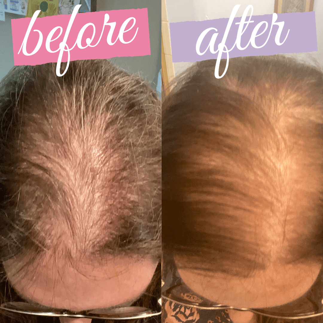 dr-g-med-spa-prp-hair-rejuvenation